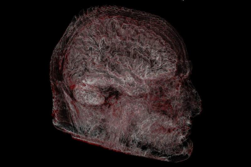 Can you rewire your brain?