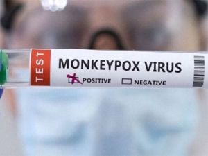 Rusia identifica dos nuevos casos de infección por viruela del mono