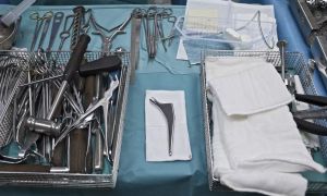 Tožba zaradi poškodbe možganskega živca po lepotni operaciji