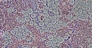 Could Glial Cells Be the Key to New Schizophrenia Treatments?