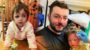 Odunla 14 aylık bebeğe saldırmak