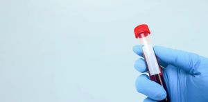 Blood tests for cancer? We’re still a way off