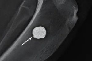 Ученые обнаружили серьезную опасность при использовании редкоземельных металлов в имплантатах