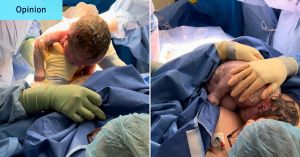 After a traumatic birth, this rarely discussed caesarean option was healing