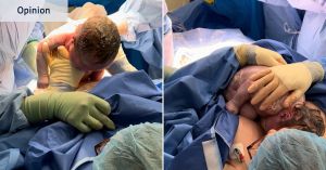 After a traumatic birth, this rarely discussed caesarean option was healing