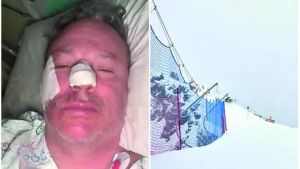 Avvocato si schianta sulla pista nera: «Il casco mi ha salvato la vita»