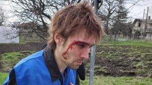 Revolt: Dinić sa prelomom i nagnječenjem mozga, ostali novinari pod nadzorom lekara