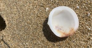 Why Shame Is Central in Trauma