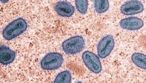 Singapore confirms first local spread of mutated monkeypox clade Ib strain