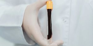 Une simple prise de sang pour traquer le cancer