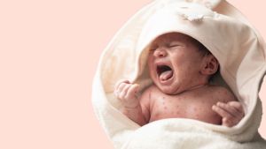 Как допуснахме завръщането на морбили, когато имаме работеща ваксина