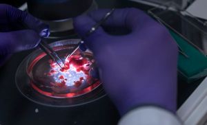 Virtudes de un pequeño cerebro