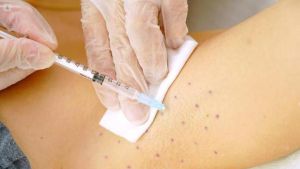 El 3% de la población sufre hiperhidrosis, el exceso de sudor que trastoca la vida: 