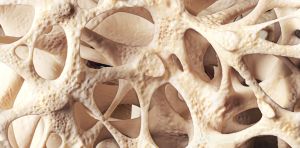 Osteopenia: loss of bone mineral density affects millions of people – here’s what you need to know