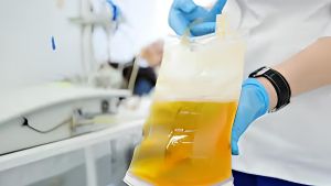 Ispezione sulle sacche di plasma gettate: guasto tecnico o malagestione? La risposta dell’Iss