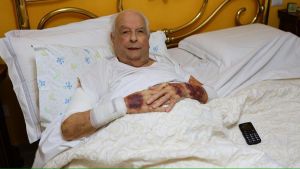 Picchiato fuori dalla mensa, Antonio è tornato a casa: “Ho rischiato di morire e non ho più la milza”