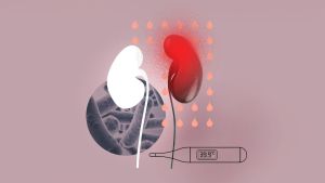 Rätselhafte Luftniere