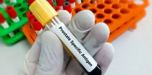 Prostate cancer overdiagnosis risk sharply rises after age 70 – new research