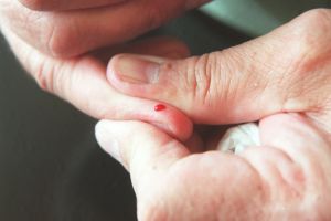 Le dépistage en milieu communautaire : une évidence pour enrayer l’hépatite C