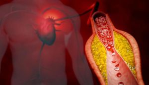 Scientists unveil breakthrough treatment that cuts bad cholesterol by 50%