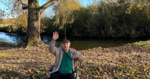 Professor's death after leg amputations ruled natural causes