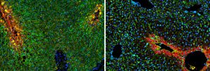 In world first, Israeli scientists map digital atlas of healthy human liver