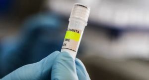 Hantavirus en crucero: ¿por qué no estamos ante un nuevo coronavirus?