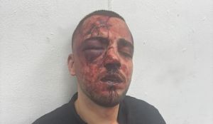 Police officers said to beat, break nose and arrest Arab prosecutor over noise complaint