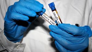 Hantavirus, negativo il test del medico sudafricano in hotel a Padova