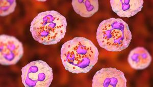 Meningitis leaves one dead, others critically ill; Know how it spreads