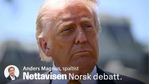 Pinlig: Alle kan se det