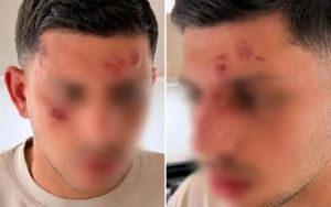 ‘Are you Jewish?’ Israeli attacked by group of men in London after speaking Hebrew