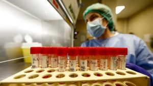 Hantavirus, c’è il piano regionale. In Veneto schierati gli ospedali universitari