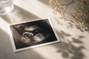 It Would Be Wise: Israel’s Prenatal Culture and the Limits of Medical Certainty