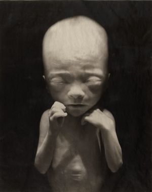 Elizabeth Heyert’s THE UNBORN – what we are all like before we enter the world