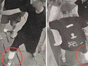 Turista scippata della collana d’oro, rapinatore tradito da una benda sulla gamba: arrestato dopo fuga tra i vicoli