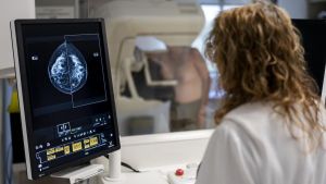 Las mamografías realizadas con IA pueden traer un aumento de detección de cáncer de mama en un 20%