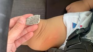 Paura a Sondrio, bimbo di 7 mesi colpito da un calcinaccio: “Salvo grazie alla tendina parasole del passeggino”