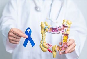 New Evidence on Colonoscopy and Colorectal Cancer Prevention