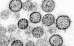 Who will release the next pandemic?