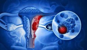 Study shows near-zero cervical cancer risk in young women