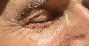 Why Old People Cry