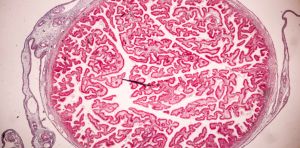 Placenta as property: why every mother deserves the right to choose