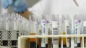 Neuromodulació en la demència