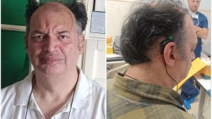 La nuova vita di Romano: “Ho scoperto i suoni del mondo grazie all’orecchio bionico”