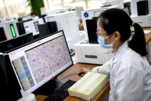 Une vaste étude révèle quels cancers possèdent leur propre microbiome