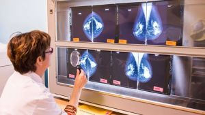 Tumori, il Veneto è tra le regioni più virtuose: ecco quanti aderiscono agli screening