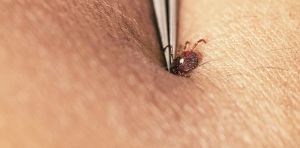 How to avoid tick bites in your yard or while hiking in the woods, and what to do if one starts feasting on you