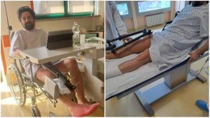 La denuncia del dottore ricoverato d’urgenza: “In carrozzina con la gamba immobilizzata dai ferri, multato in ospedale”