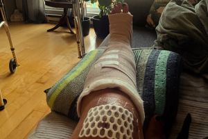 Drimonis: My broken leg and our fractured health care network